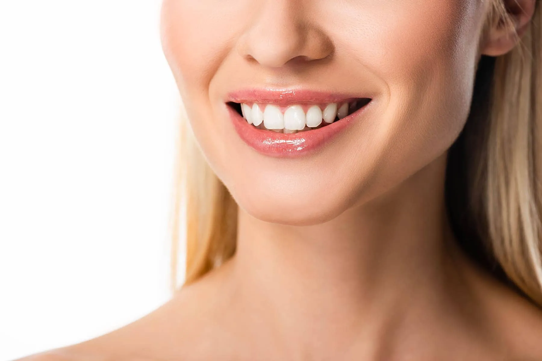 teeth veneers