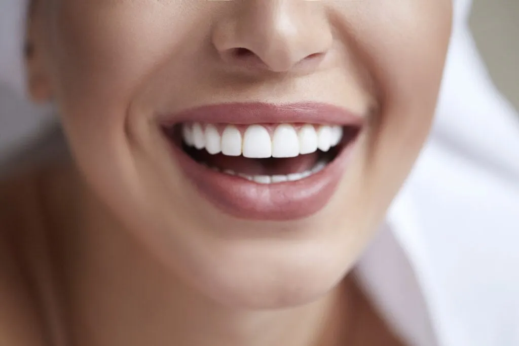 porcelain veneers melbourne