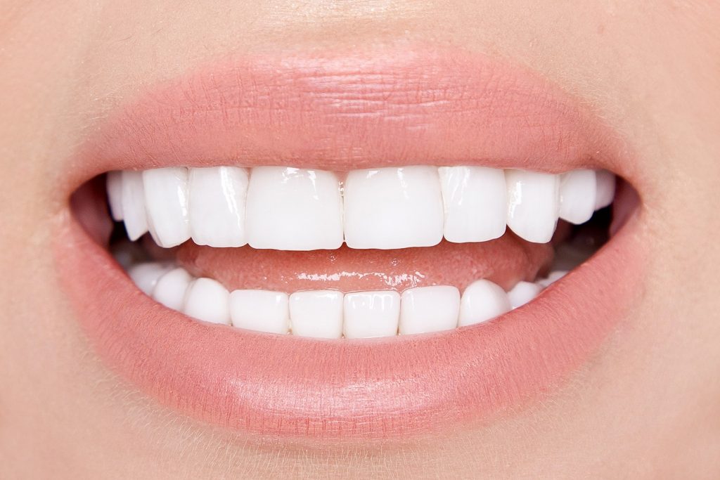The Complete Guide to Getting Veneers