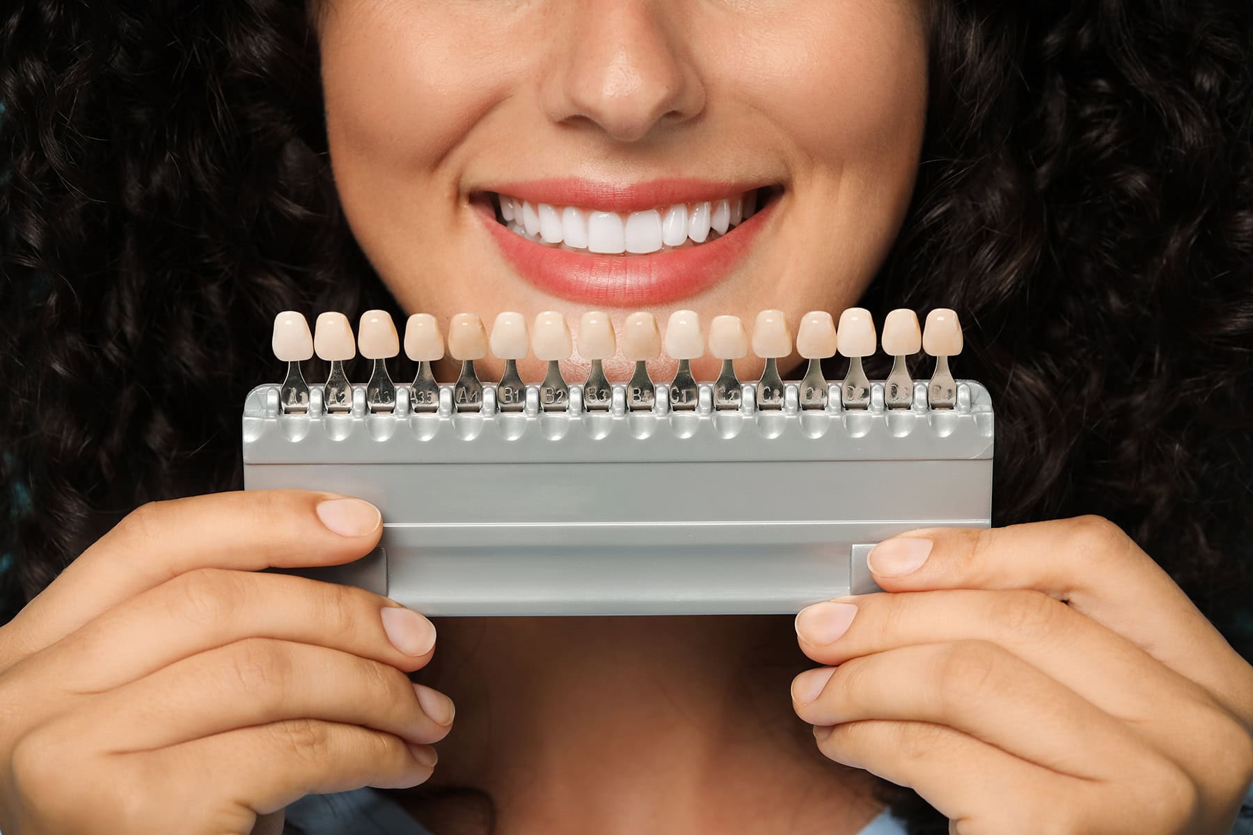 bad veneers