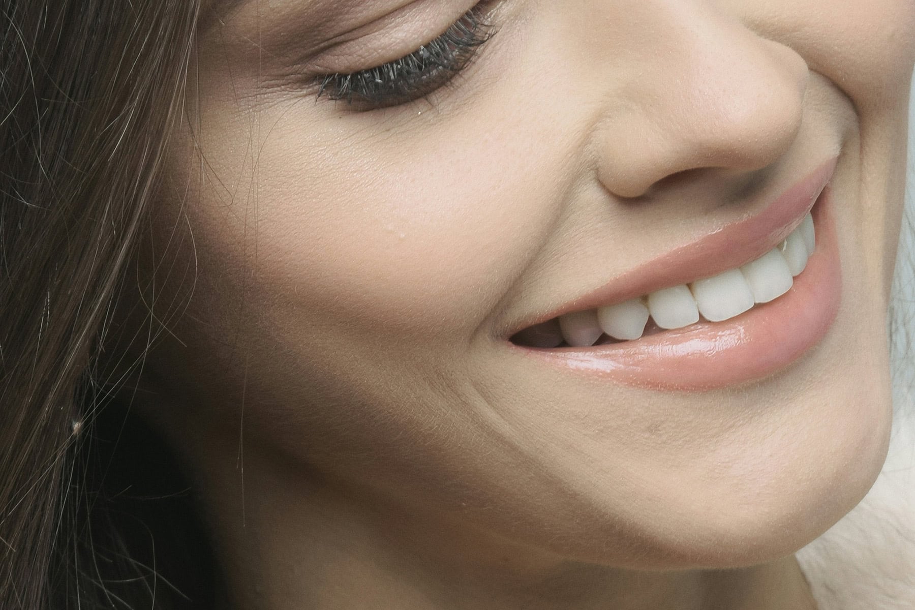 how long veneers last